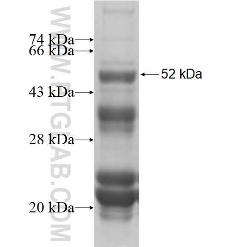 CAMTA2 fusion protein Ag4263 SDS-PAGE