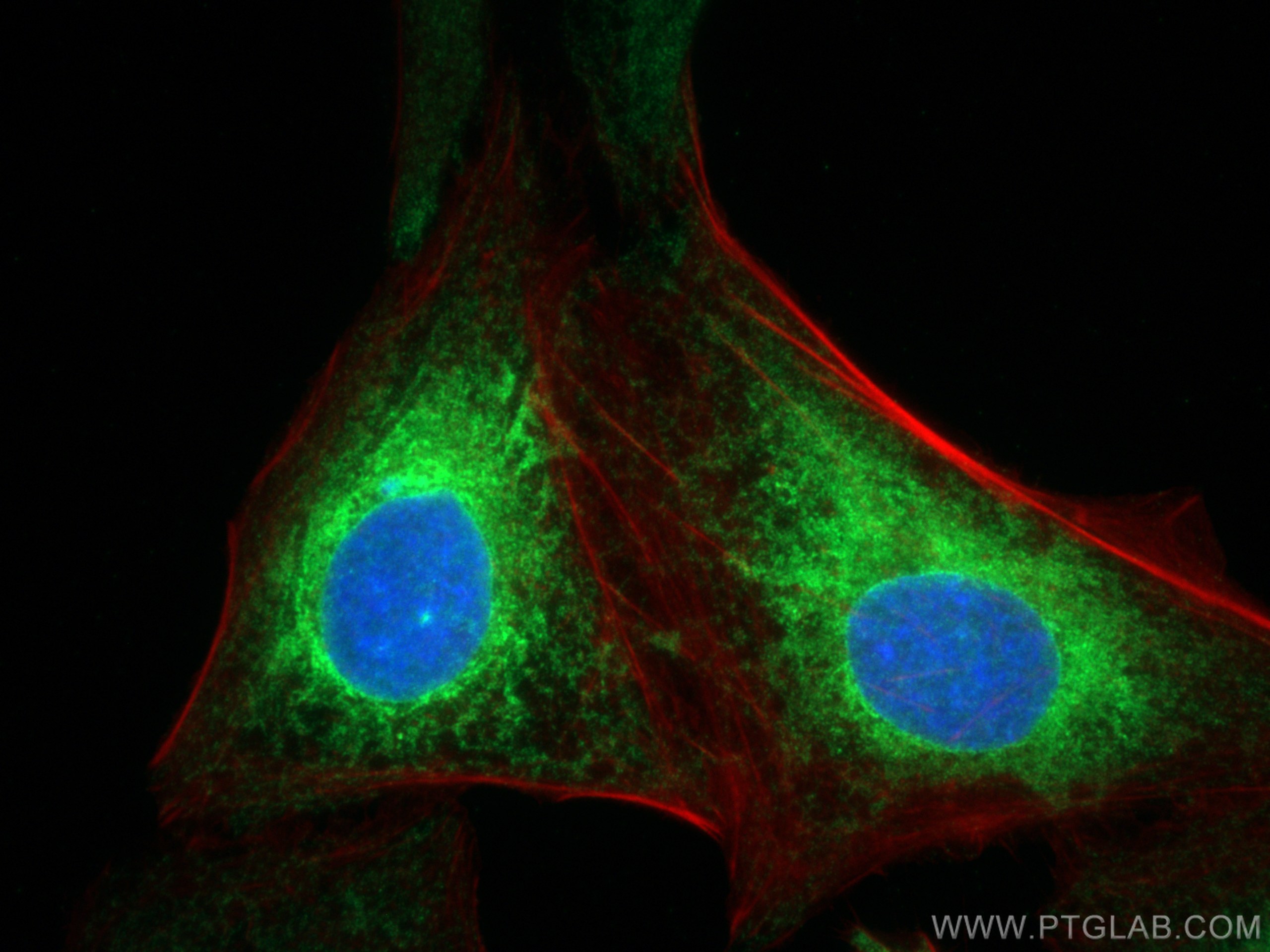 Immunofluorescence (IF) / fluorescent staining of SKOV-3 cells using Calnexin Polyclonal antibody (10427-2-AP)