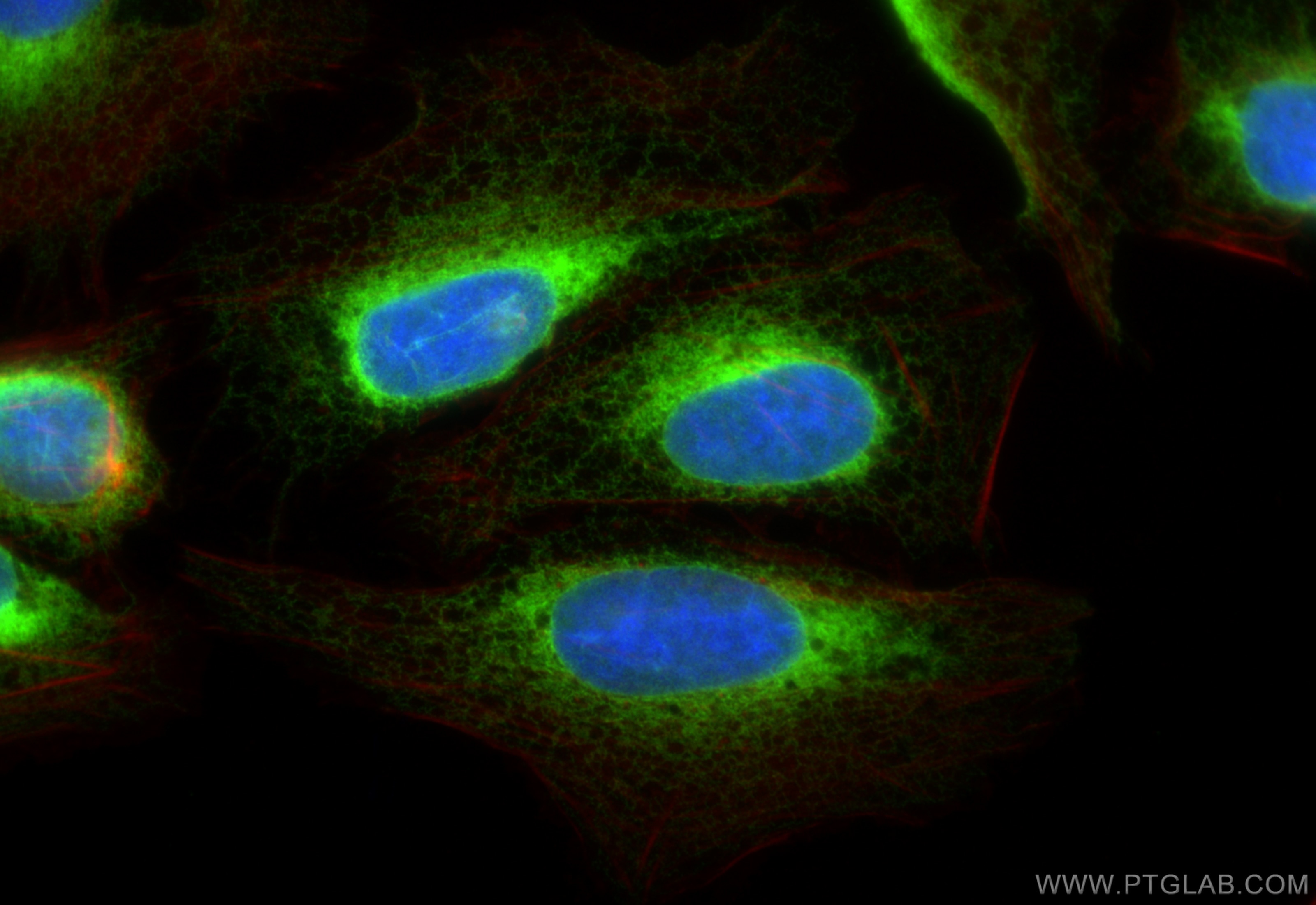 Immunofluorescence (IF) / fluorescent staining of U2OS cells using Calnexin Polyclonal antibody (10427-2-AP)