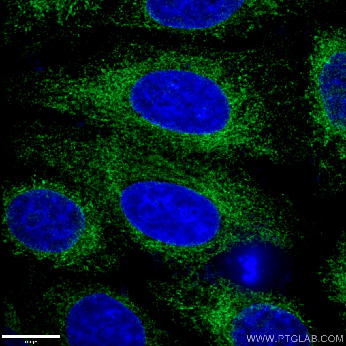 Immunofluorescence (IF) / fluorescent staining of HepG2 cells using Calnexin Polyclonal antibody (10427-2-AP)