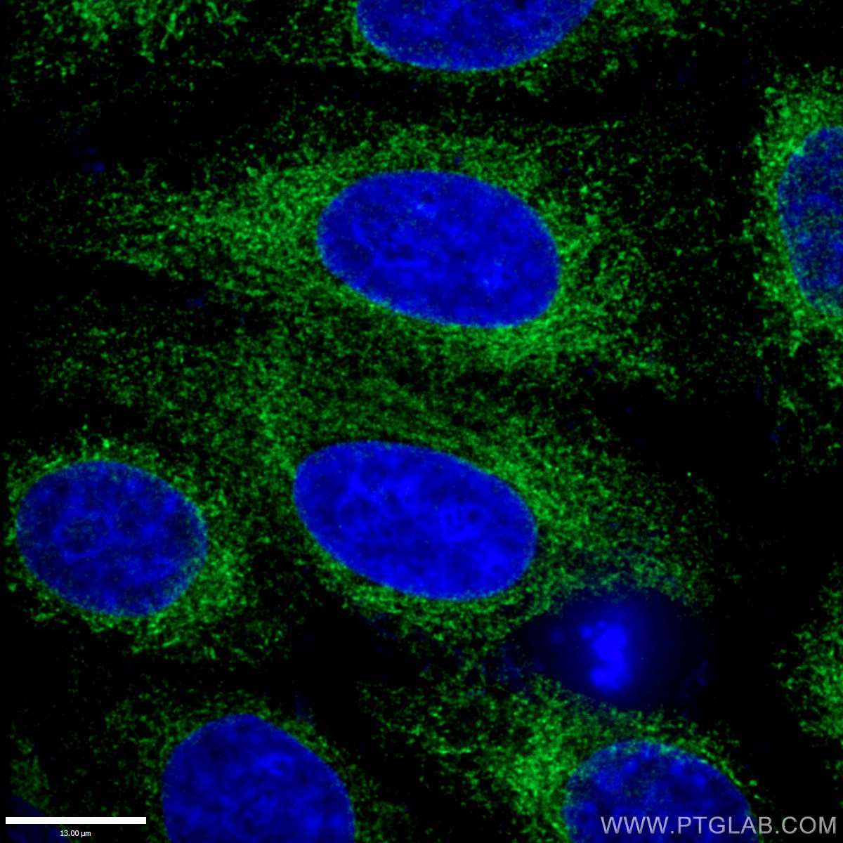 IF Staining of HepG2 using 10427-2-AP