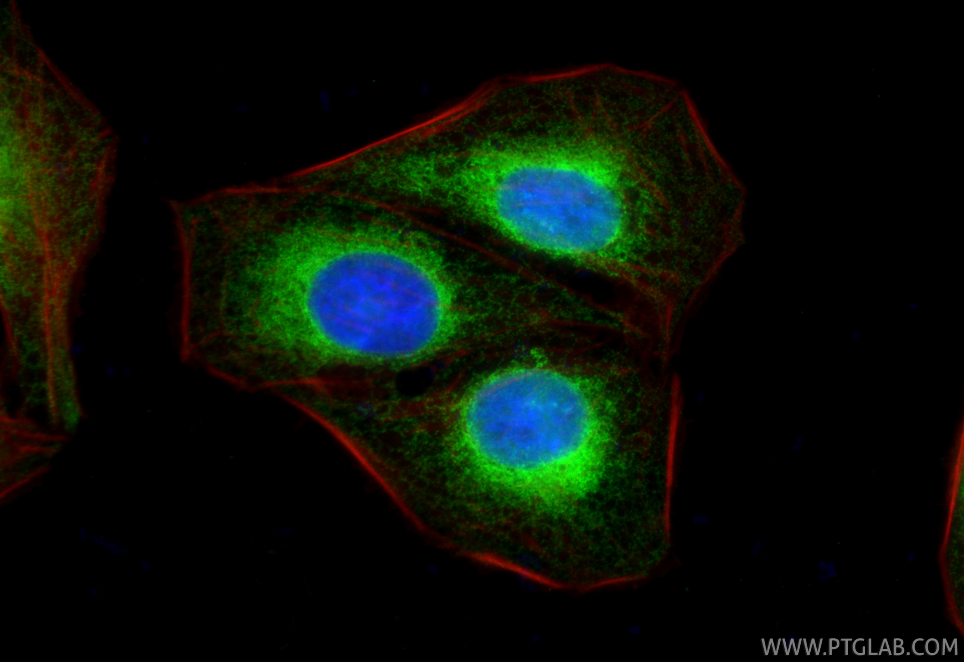 Immunofluorescence (IF) / fluorescent staining of U2OS cells using Calnexin Polyclonal antibody (10427-2-AP)