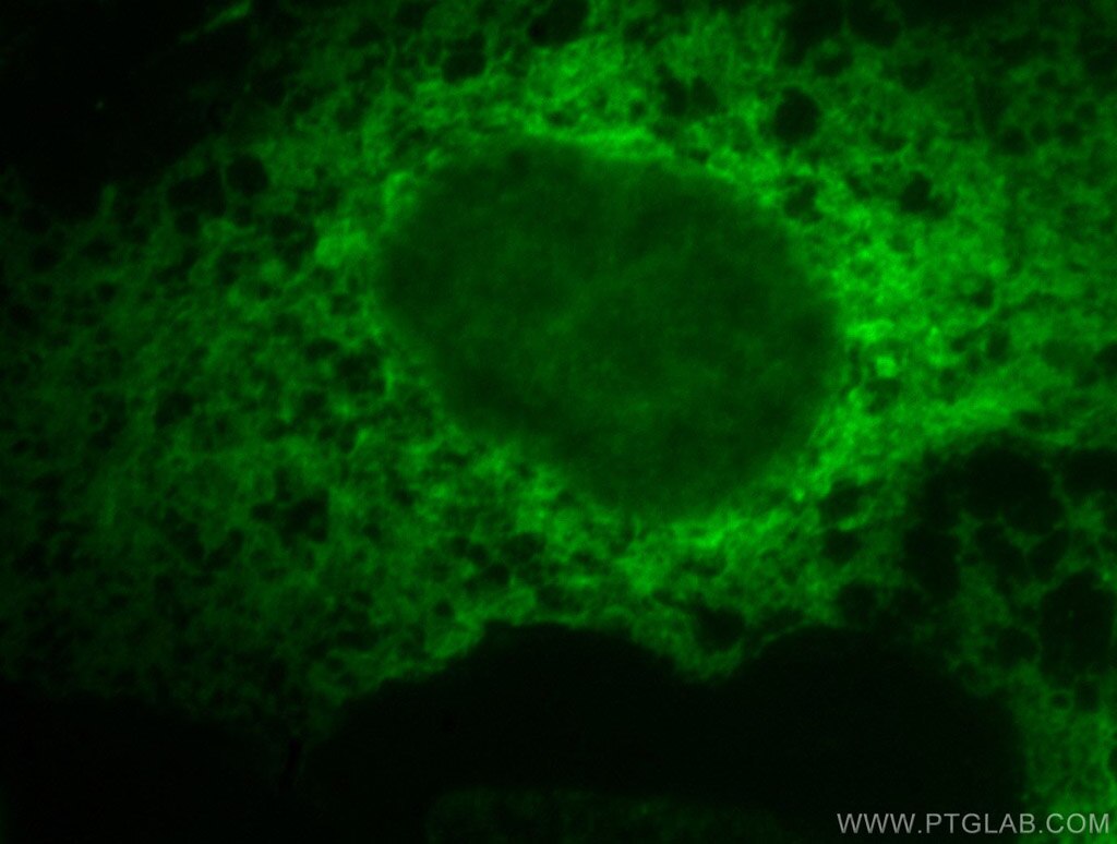 Calnexin Polyclonal antibody