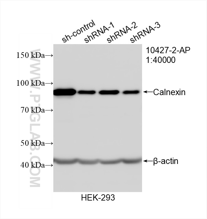 Western Blot (WB) analysis of HEK-293 cells using Calnexin Polyclonal antibody (10427-2-AP)