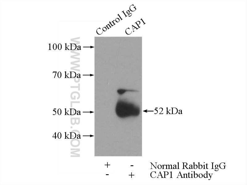 Immunoprecipitation (IP) experiment of A431 cells using CAP1 Polyclonal antibody (16231-1-AP)