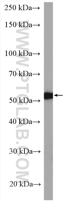 Western Blot (WB) analysis of COLO 320 cells using CAP1 Polyclonal antibody (16231-1-AP)