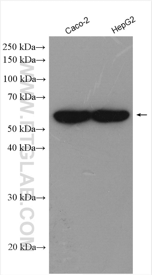 Western Blot (WB) analysis of various lysates using CAP1 Polyclonal antibody (16231-1-AP)