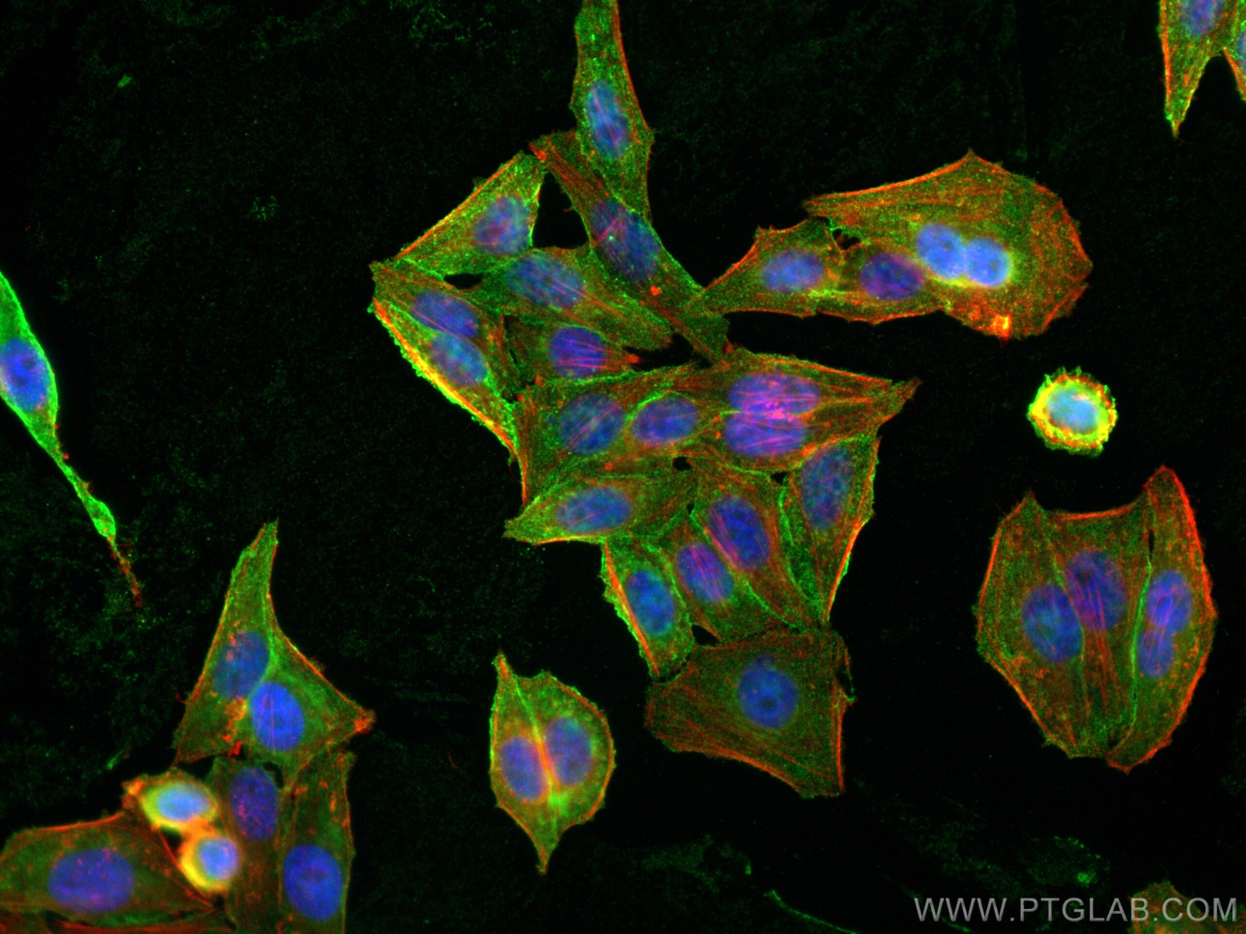 Immunofluorescence (IF) / fluorescent staining of HepG2 cells using CAP1 Monoclonal antibody (68207-1-Ig)
