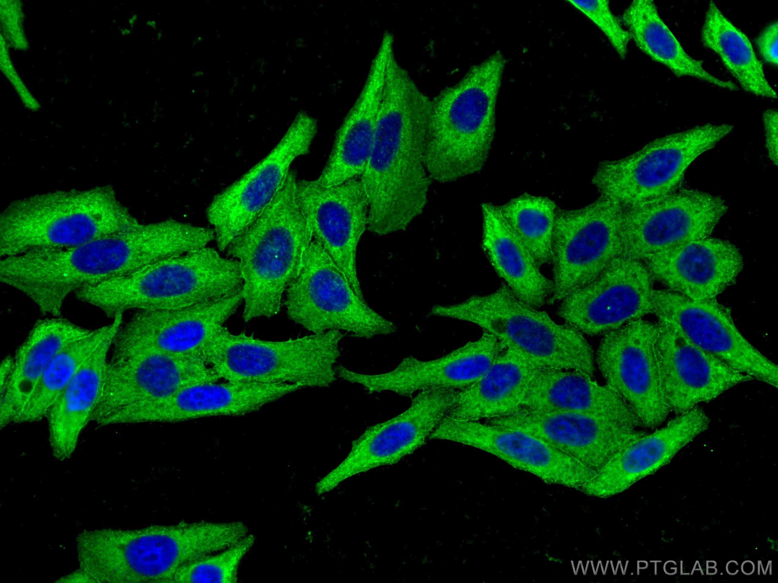 Immunofluorescence (IF) / fluorescent staining of HepG2 cells using CAP1 Monoclonal antibody (68207-1-Ig)