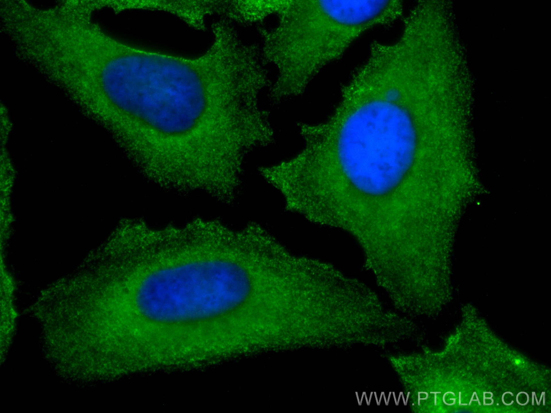 Immunofluorescence (IF) / fluorescent staining of HeLa cells using CAP1 Monoclonal antibody (68207-1-Ig)
