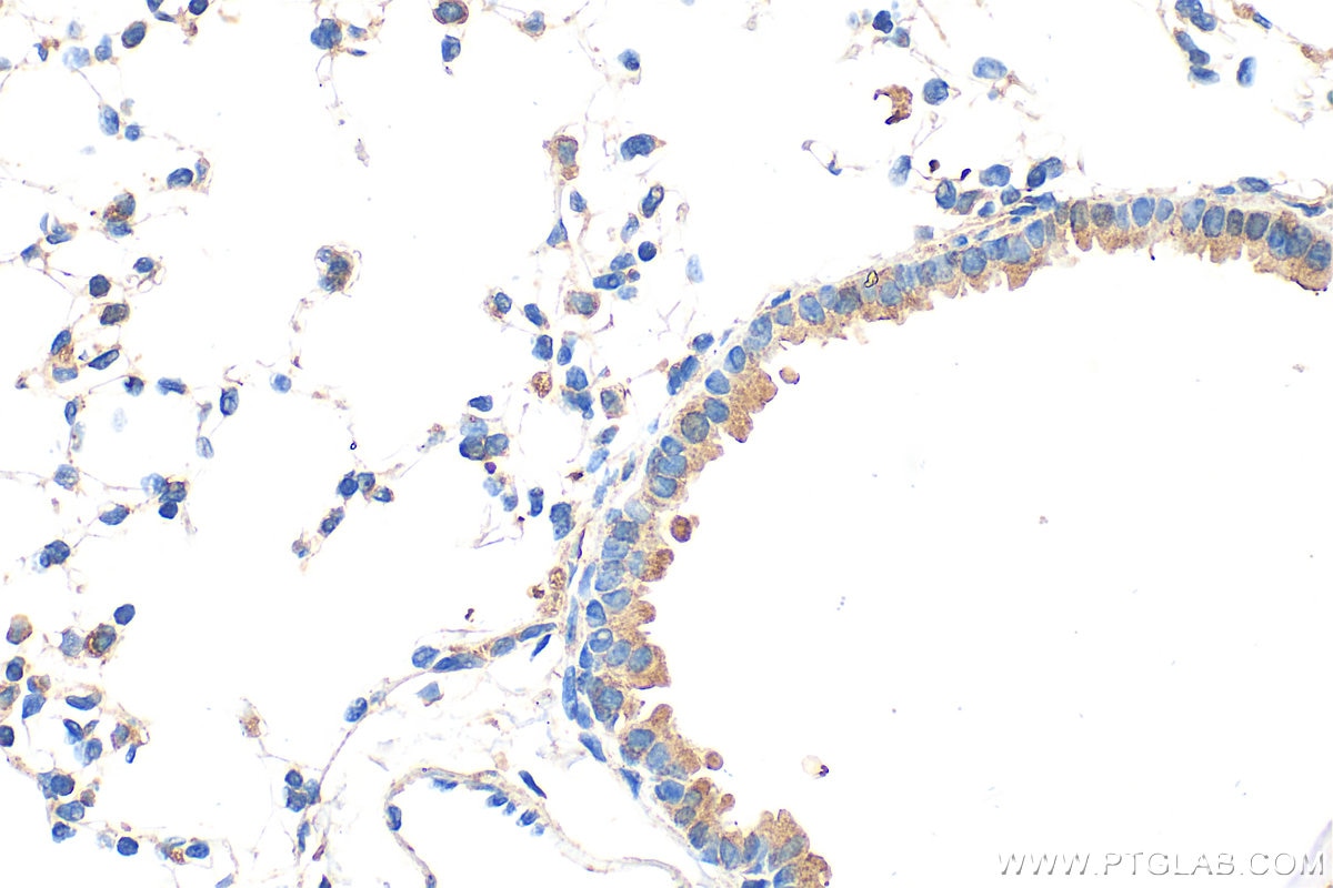 Immunohistochemical analysis of paraffin-embedded mouse lung tissue slide using 68207-1-Ig (CAP1 antibody) at dilution of 1:1000 (under 40x lens). Heat mediated antigen retrieval with Tris-EDTA buffer (pH 9.0). Immunohistochemistry (IHC) staining of mouse lung tissue using CAP1 Monoclonal antibody (68207-1-Ig)