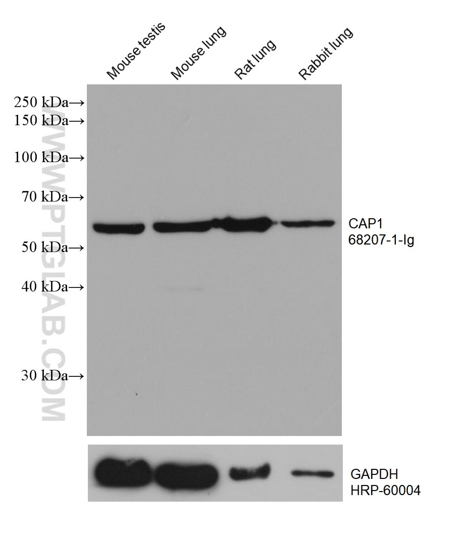 Western Blot (WB) analysis of various lysates using CAP1 Monoclonal antibody (68207-1-Ig)