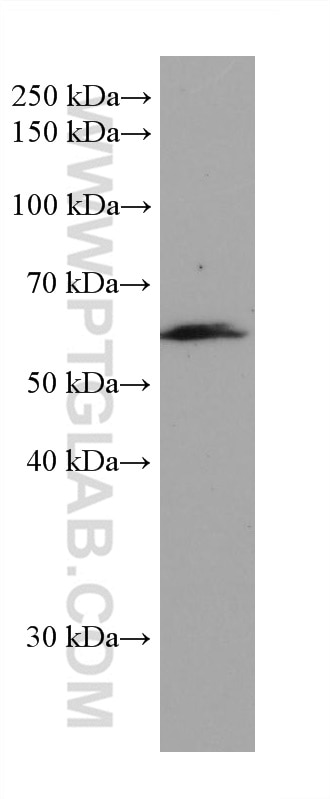 Western Blot (WB) analysis of pig lung tissue using CAP1 Monoclonal antibody (68207-1-Ig)