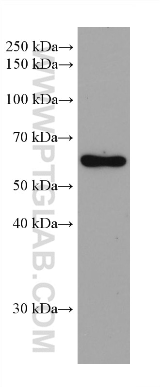 Western Blot (WB) analysis of human placenta tissue using CAP1 Monoclonal antibody (68207-1-Ig)