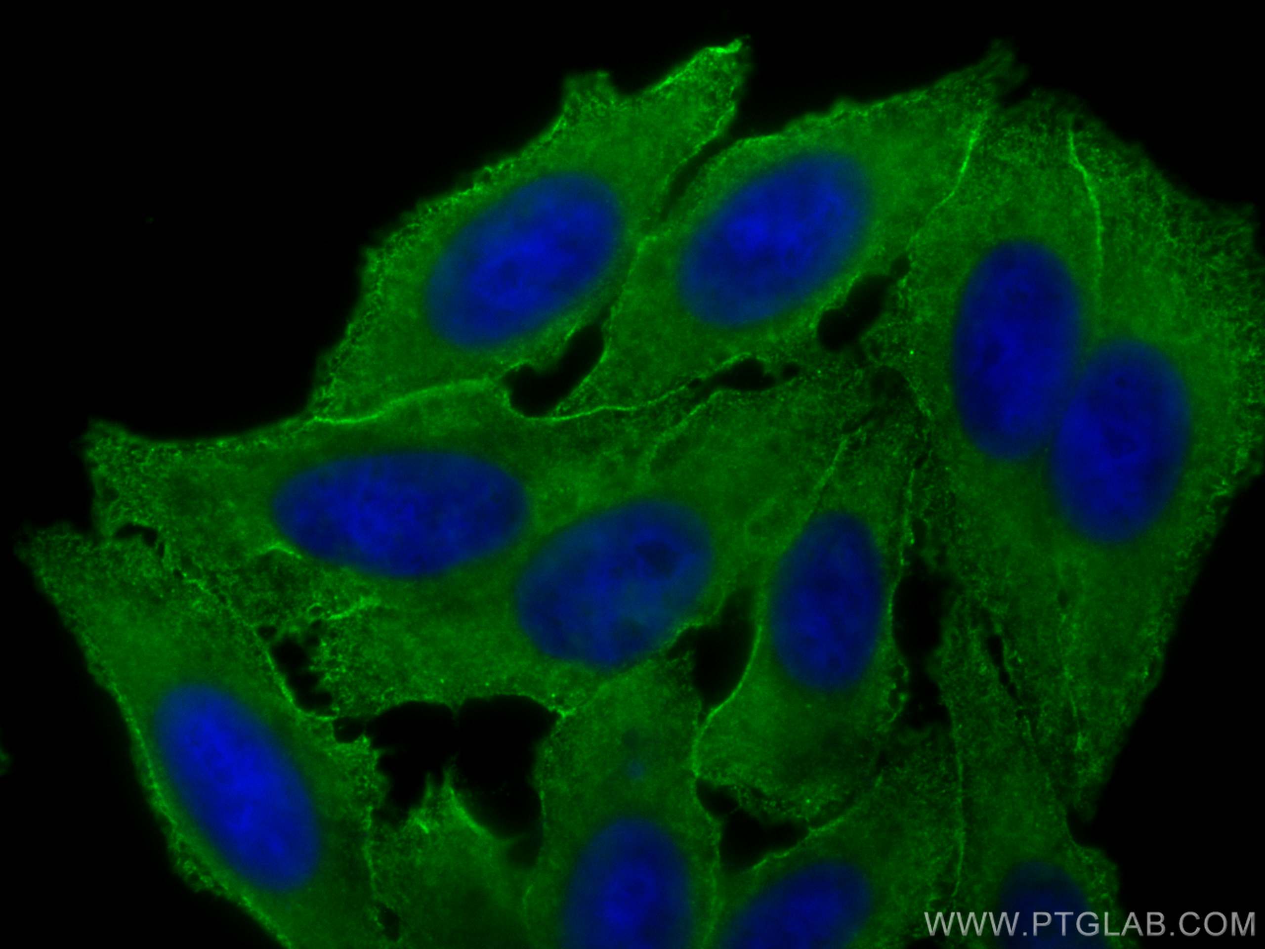 Immunofluorescence (IF) / fluorescent staining of HepG2 cells using CoraLite® Plus 488-conjugated CAP1 Monoclonal anti (CL488-68207)