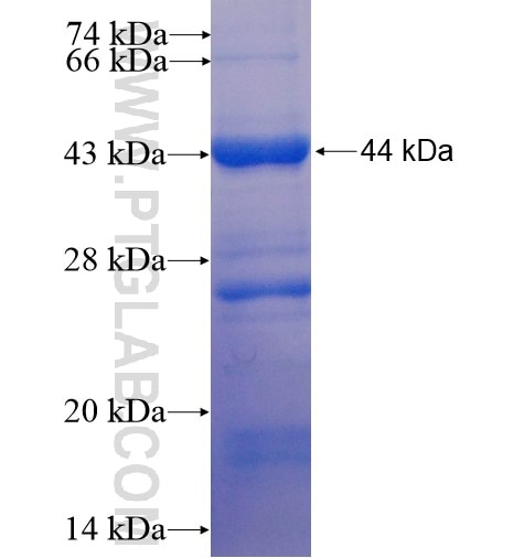 CAP1 fusion protein Ag8876 SDS-PAGE