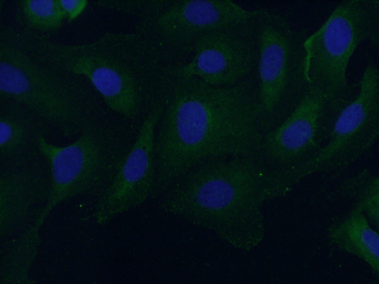 Immunofluorescence (IF) / fluorescent staining of U2OS cells using CAP2 Polyclonal antibody (15865-1-AP)