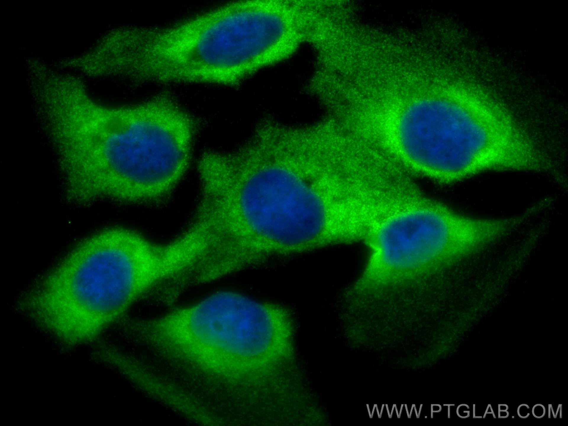 Immunofluorescence (IF) / fluorescent staining of U2OS cells using CAP2 Polyclonal antibody (15865-1-AP)