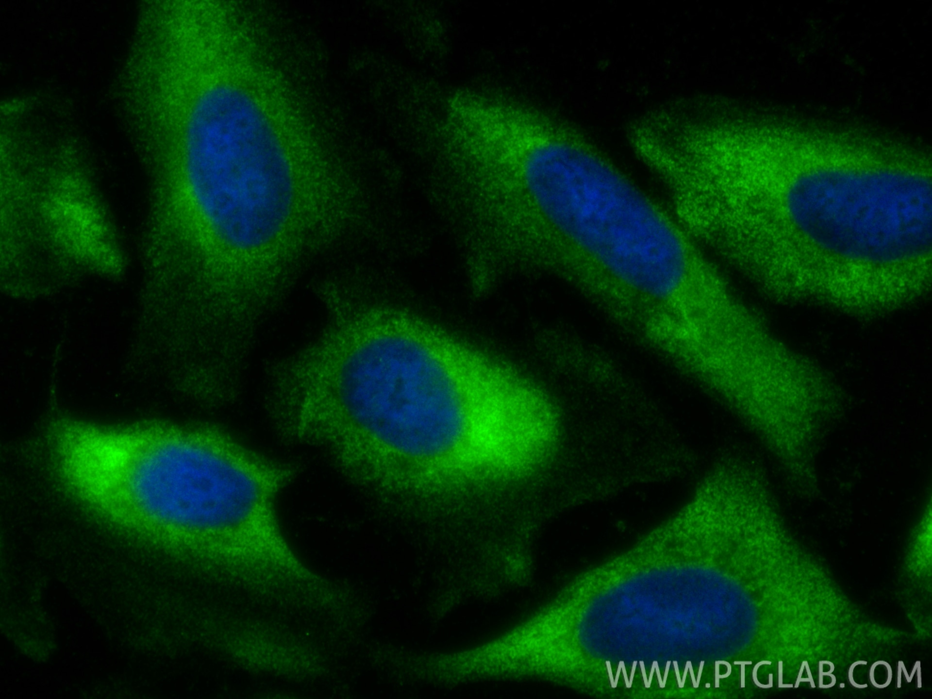 IF Staining of U2OS using 15865-1-AP Immunofluorescence (IF) / fluorescent staining of U2OS cells using CAP2 Polyclonal antibody (15865-1-AP)