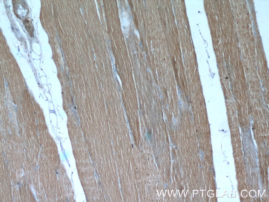 Immunohistochemistry (IHC) staining of human skeletal muscle tissue using CAP2 Polyclonal antibody (15865-1-AP)