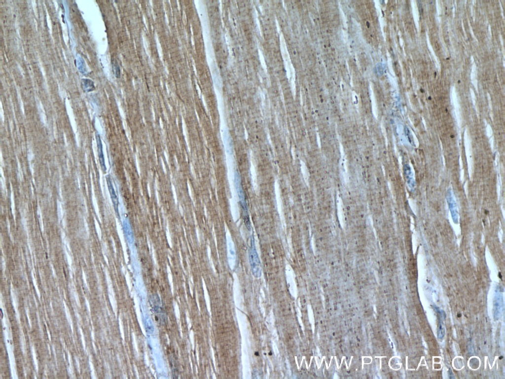 Immunohistochemistry (IHC) staining of human skeletal muscle tissue using CAP2 Polyclonal antibody (15865-1-AP)