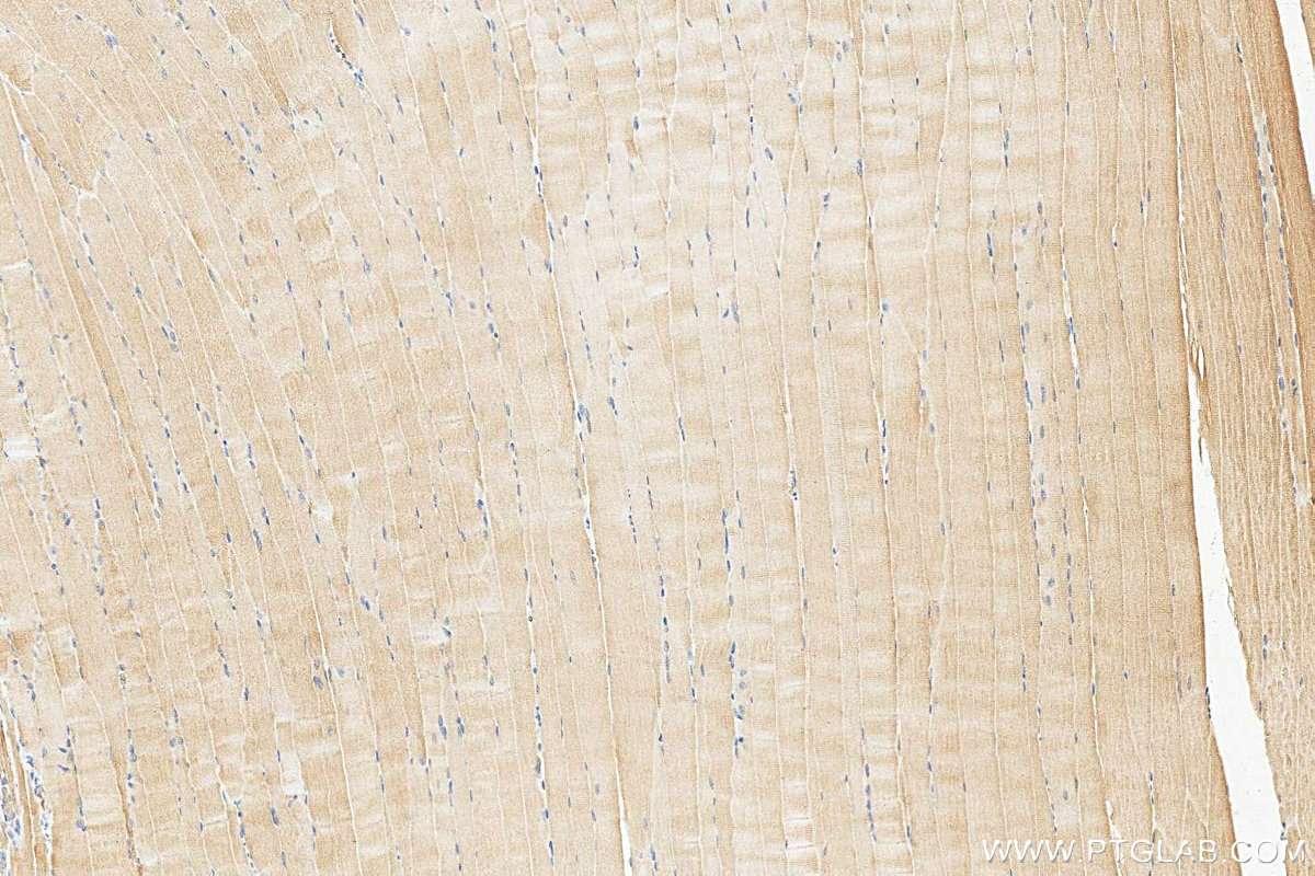 IHC staining of mouse skeletal muscle using 15865-1-AP Immunohistochemistry (IHC) staining of mouse skeletal muscle tissue using CAP2 Polyclonal antibody (15865-1-AP)