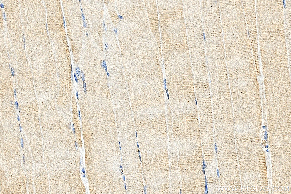 IHC staining of mouse skeletal muscle using 15865-1-AP Immunohistochemistry (IHC) staining of mouse skeletal muscle tissue using CAP2 Polyclonal antibody (15865-1-AP)