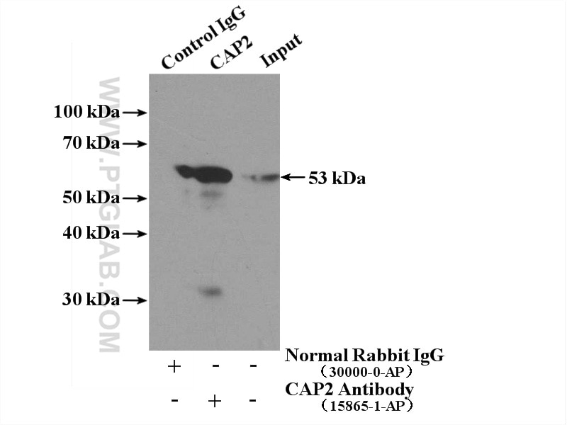 Immunoprecipitation (IP) experiment of mouse testis tissue using CAP2 Polyclonal antibody (15865-1-AP)
