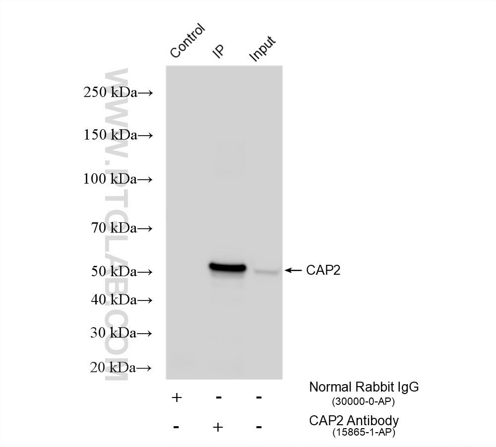 IP experiment of PC-3 using 15865-1-AP Immunoprecipitation (IP) experiment of PC-3 cells using CAP2 Polyclonal antibody (15865-1-AP)