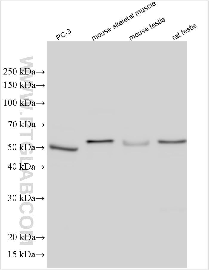 Western Blot (WB) analysis of various lysates using CAP2 Polyclonal antibody (15865-1-AP)