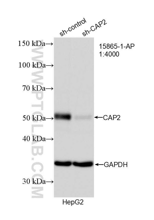 WB result of CAP2 antibody (15865-1-AP; 1:4000; incubated at room temperature for 1.5 hours) with sh-Control and sh-CAP2 transfected HepG2 cells. Western Blot (WB) analysis of HepG2 cells using CAP2 Polyclonal antibody (15865-1-AP)