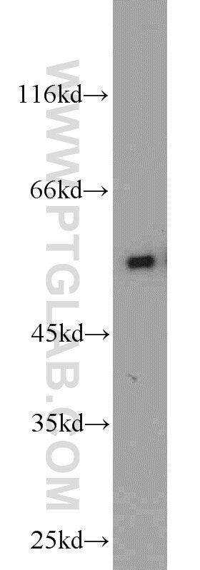 Western Blot (WB) analysis of mouse heart tissue using CAP2 Polyclonal antibody (15865-1-AP)