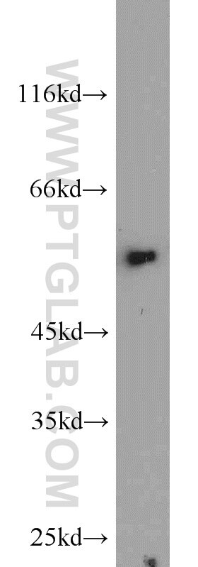CAP2 antibody (15865-1-AP) | Proteintech