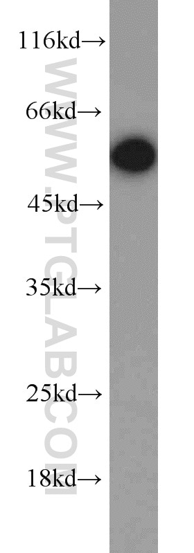 Western Blot (WB) analysis of mouse skeletal muscle tissue using CAP2 Polyclonal antibody (15865-1-AP)