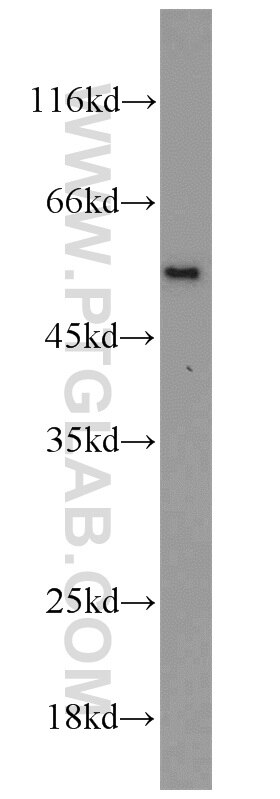 Western Blot (WB) analysis of mouse testis tissue using CAP2 Polyclonal antibody (15865-1-AP)