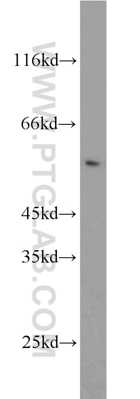 Western Blot (WB) analysis of PC-3 cells using CAP2 Polyclonal antibody (15865-1-AP)
