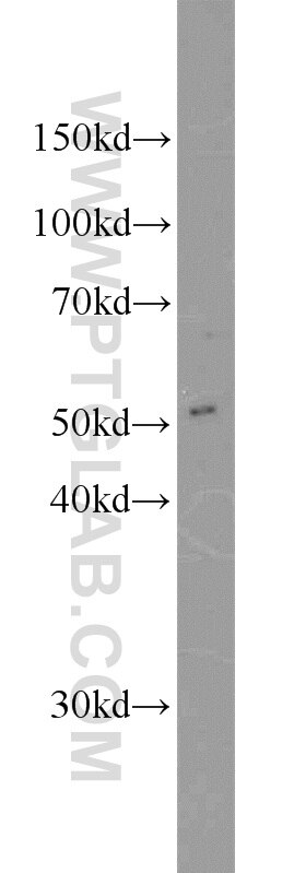 Western Blot (WB) analysis of mouse kidney tissue using CAP2 Polyclonal antibody (15865-1-AP)