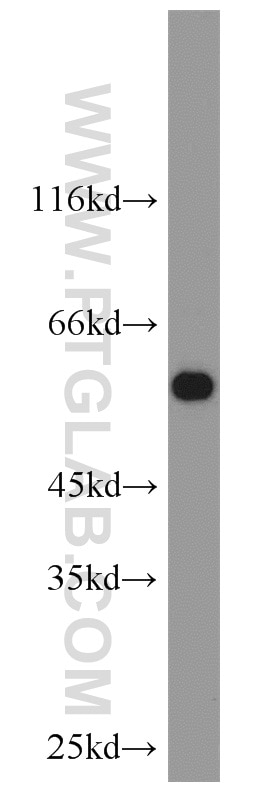 Western Blot (WB) analysis of rat testis tissue using CAP2 Polyclonal antibody (15865-1-AP)
