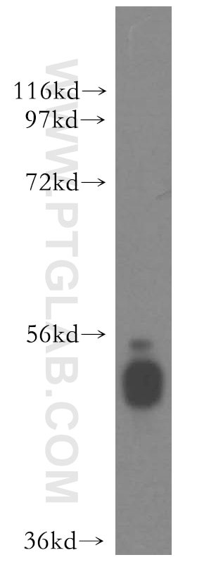 Western Blot (WB) analysis of HepG2 cells using CAP2 Polyclonal antibody (15865-1-AP)