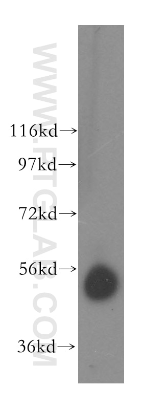 Western Blot (WB) analysis of human kidney tissue using CAP2 Polyclonal antibody (15865-1-AP)