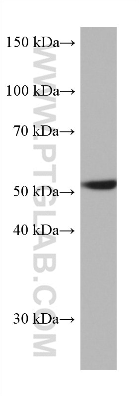 Western Blot (WB) analysis of A549 cells using CAP2 Monoclonal antibody (67412-1-Ig)