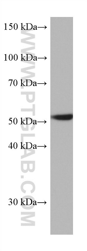 Western Blot (WB) analysis of A549 cells using CAP2 Monoclonal antibody (67412-1-Ig)