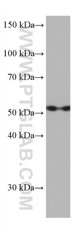 Western Blot (WB) analysis of HeLa cells using CAP2 Monoclonal antibody (67412-1-Ig)
