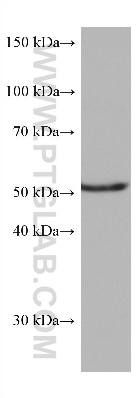 Western Blot (WB) analysis of PC-3 cells using CAP2 Monoclonal antibody (67412-1-Ig)