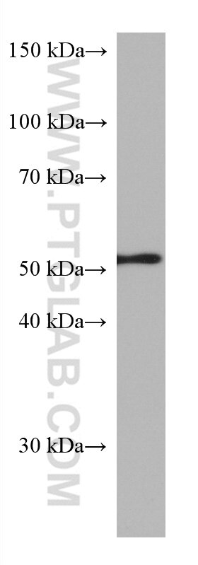 Western Blot (WB) analysis of COLO 320 cells using CAP2 Monoclonal antibody (67412-1-Ig)