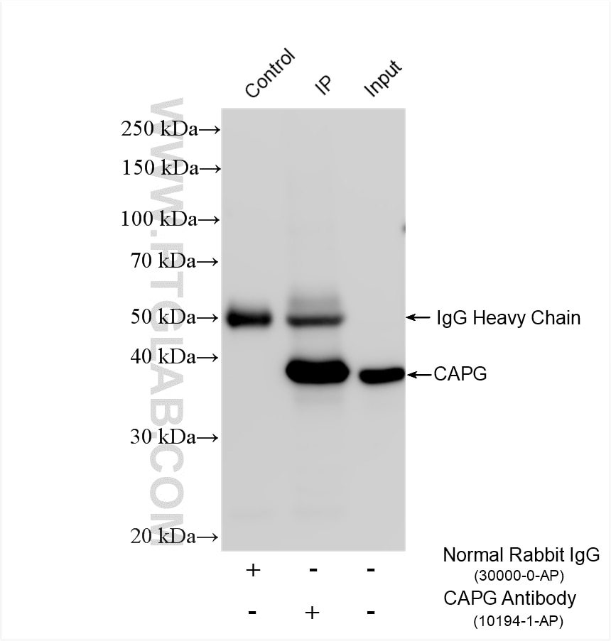 IP result of anti-CAPG (IP:10194-1-AP, 4ug; Detection:10194-1-AP 1:1000) with mouse heart tissue lysate 2080 ug. Immunoprecipitation (IP) experiment of mouse heart tissue using CAPG Polyclonal antibody (10194-1-AP)