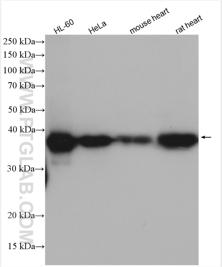 Western Blot (WB) analysis of various lysates using CAPG Polyclonal antibody (10194-1-AP)