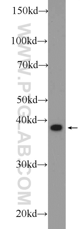 Western Blot (WB) analysis of rat lung tissue using CAPG Polyclonal antibody (10194-1-AP)