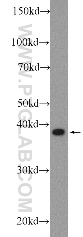 WB analysis of rat lung using 10194-1-AP