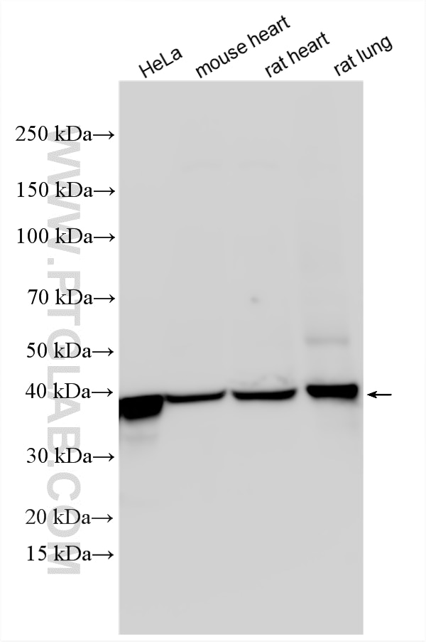 Various lysates were subjected to SDS PAGE followed by western blot with 10194-1-AP (CAPG antibody) at dilution of 1:3000 incubated at room temperature for 1.5 hours. Western Blot (WB) analysis of various lysates using CAPG Polyclonal antibody (10194-1-AP)